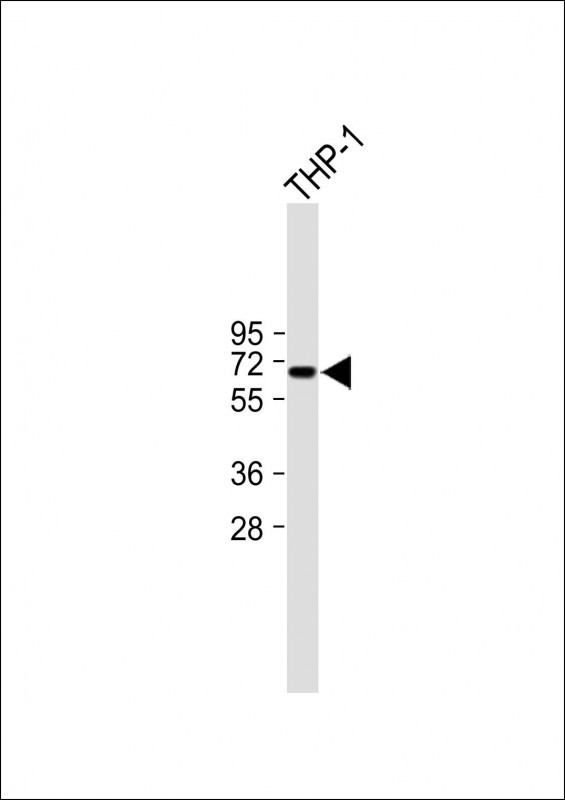 Rabbit Polyclonal Antibody to ND5