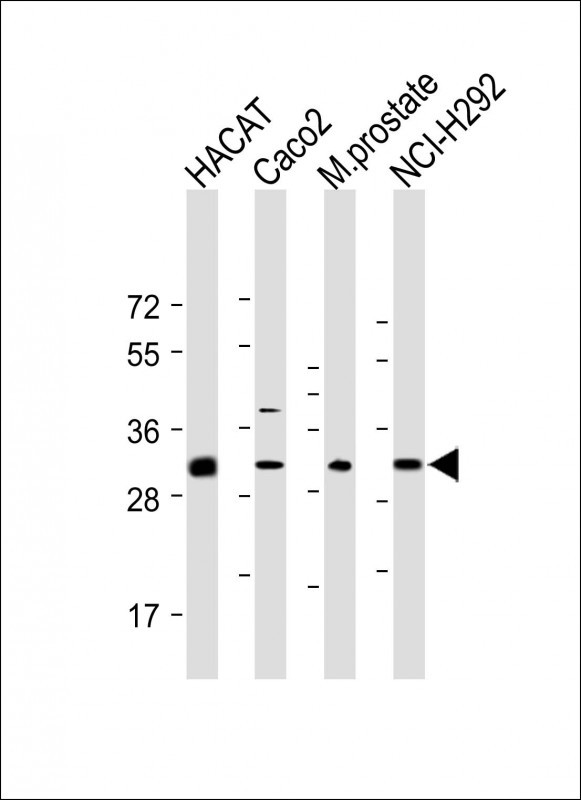 Rabbit Polyclonal Antibody to UPK1B