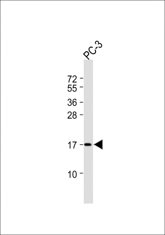 Rabbit Polyclonal Antibody to CCDC58 (N-term)