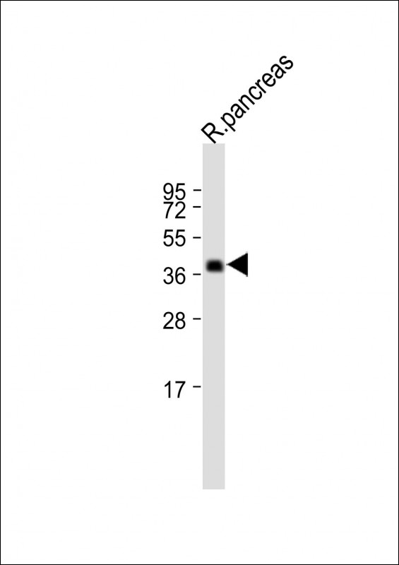 Rabbit Polyclonal Antibody to SLC30A7 (N-term)
