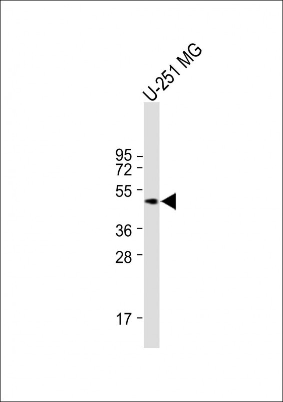 Rabbit Polyclonal Antibody to Mouse Mapkapk5 (N-term)