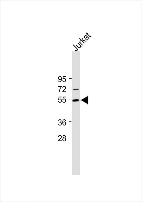 Rabbit Polyclonal Antibody to Mouse Chek1