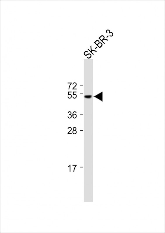 Rabbit Polyclonal Antibody to SLC36A3 (N-term)