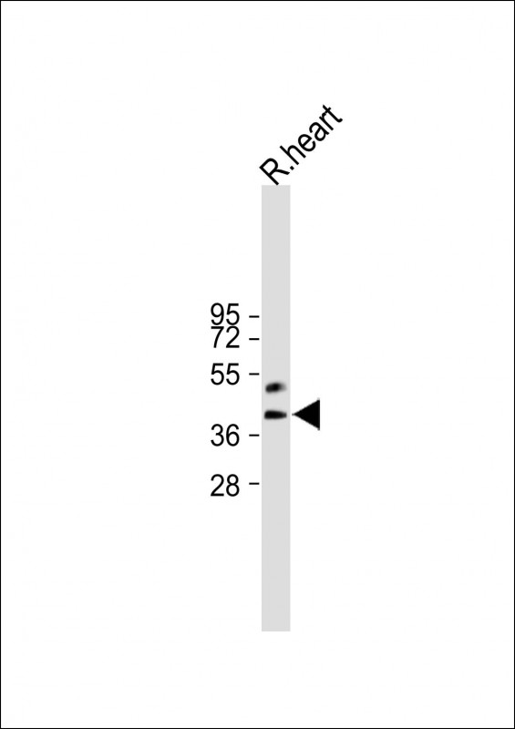 Rabbit Polyclonal Antibody to HEY2 (N-term)