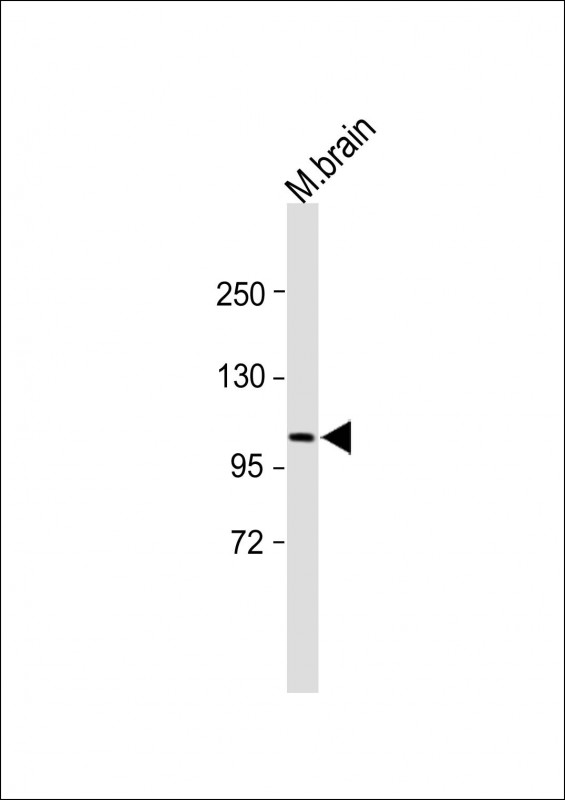 Rabbit Polyclonal Antibody to PSA