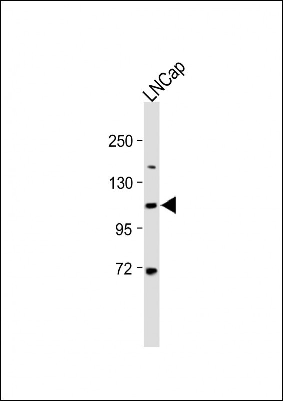 Rabbit Polyclonal Antibody to EphA7