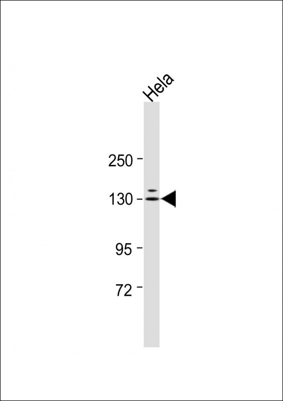 Rabbit Polyclonal Antibody to PRK2