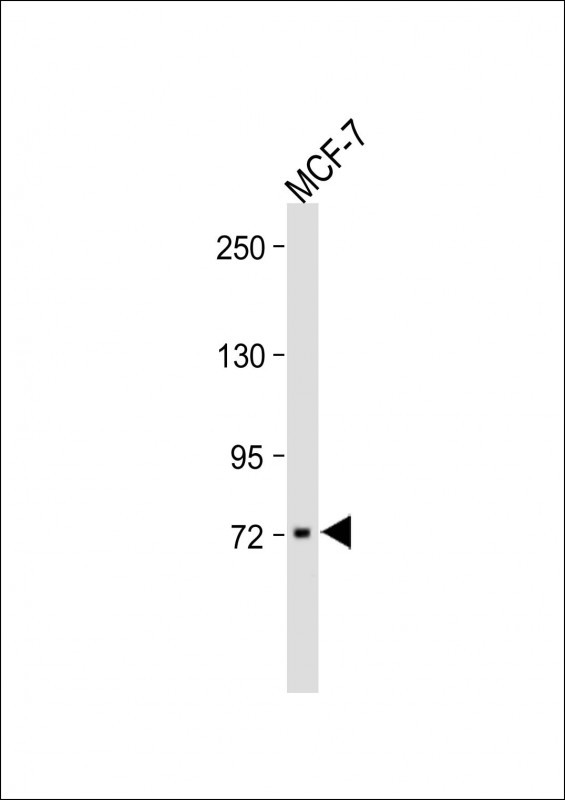 Rabbit Polyclonal Antibody to RNF43