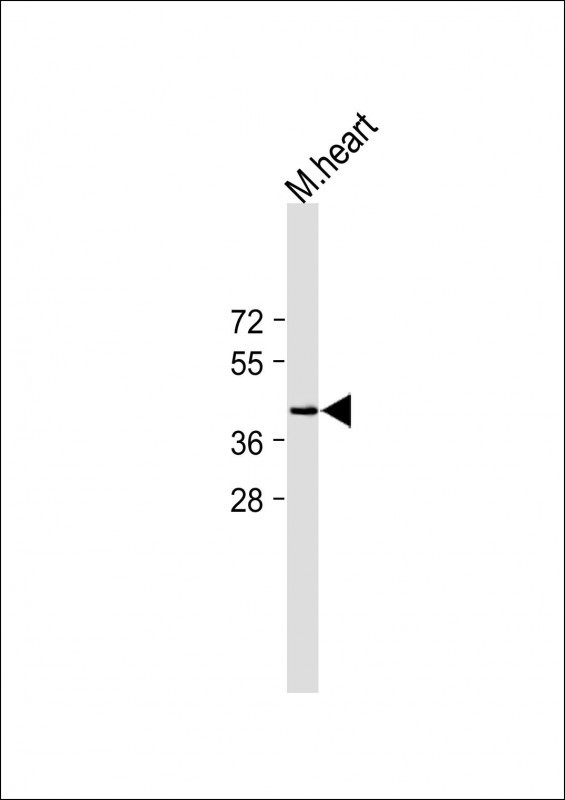 Rabbit Polyclonal Antibody to NHLRC1
