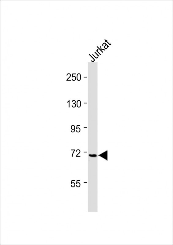 Rabbit Polyclonal Antibody to Mouse Itk (N-term)