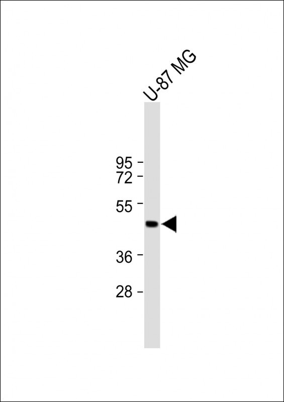 Rabbit Polyclonal Antibody to CXorf39
