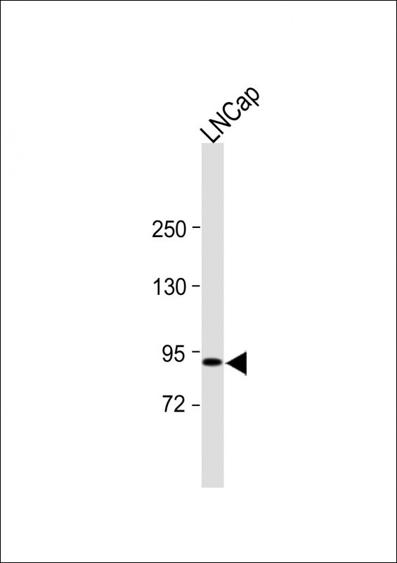 Rabbit Polyclonal Antibody to TRPV6