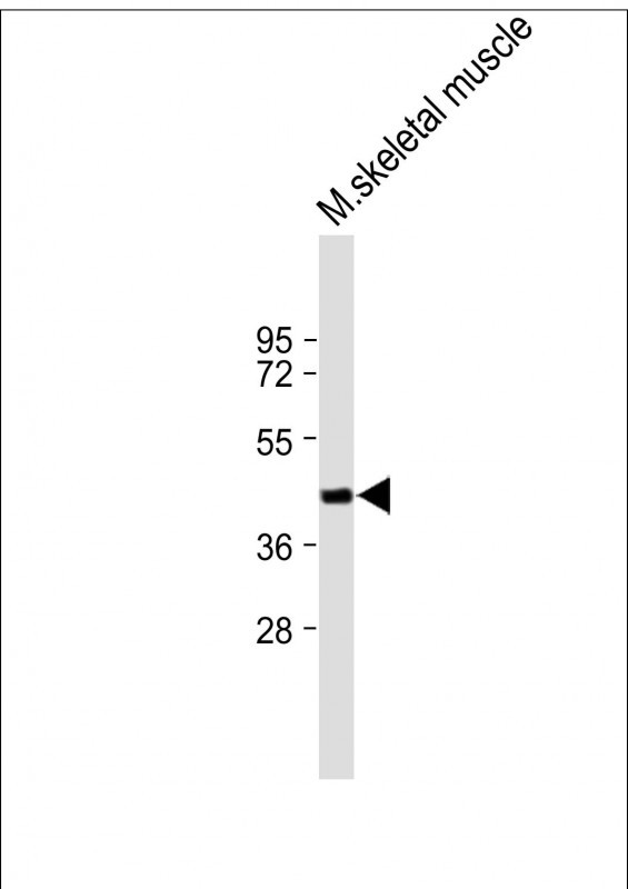Rabbit Polyclonal Antibody to FAM43A (N-term)