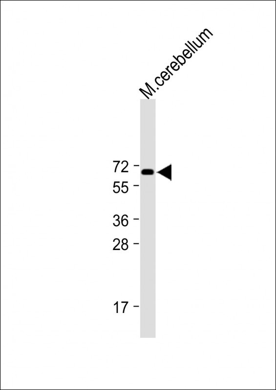 Rabbit Polyclonal Antibody to CF150