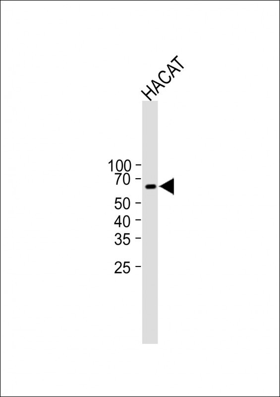 Rabbit Polyclonal Antibody to ESCO2