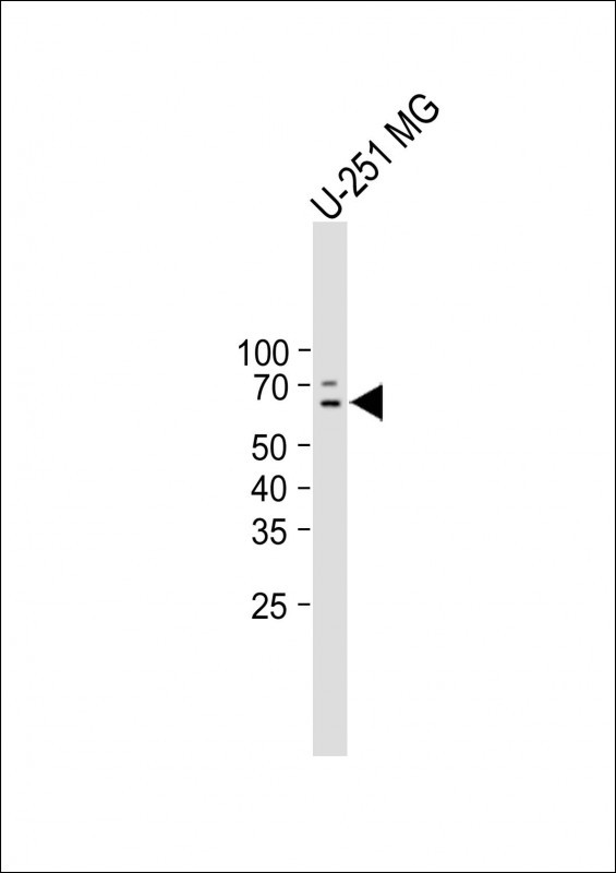 Rabbit Polyclonal Antibody to CR1L  (C-term)