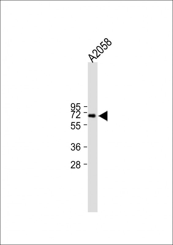 Rabbit Polyclonal Antibody to RORA (T216)