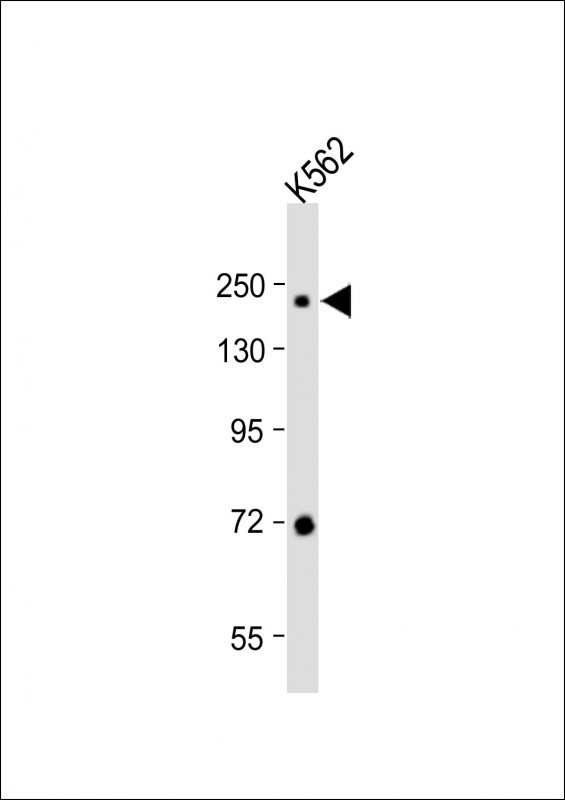Rabbit Polyclonal Antibody to MOZ/MYST3