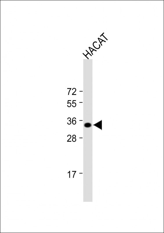 Rabbit Polyclonal Antibody to FCN3