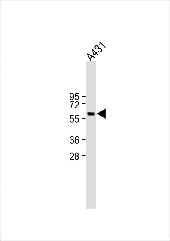 Rabbit Polyclonal Antibody to KIAA0895 (N-term)