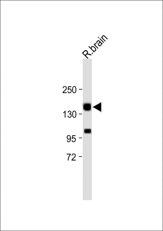 Rabbit Polyclonal Antibody to Mouse Erbb4