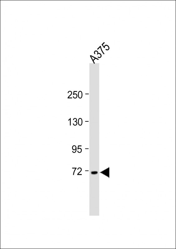Rabbit Polyclonal Antibody to IL20RA