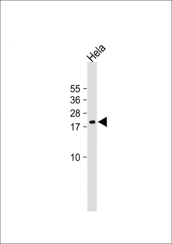 Rabbit Polyclonal Antibody to NDUFAB1