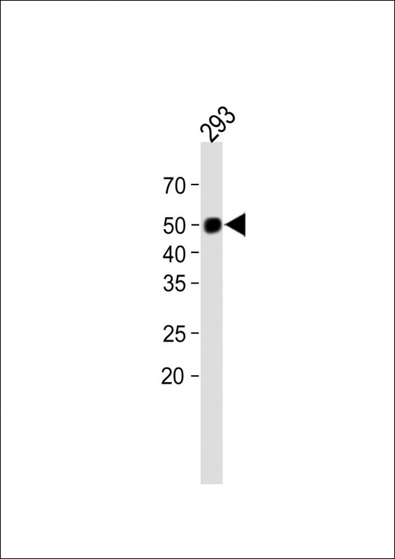 Rabbit Polyclonal Antibody to MBOAT7(Center)