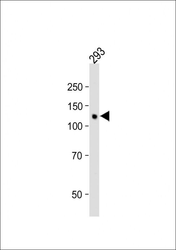 Rabbit Polyclonal Antibody to PRDM16