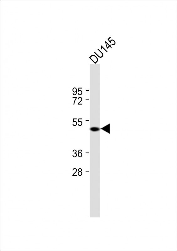 Rabbit Polyclonal Antibody to CRIPAK