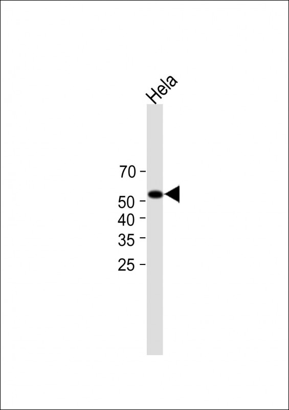 Rabbit Polyclonal Antibody to KLF4(S254)