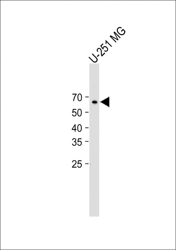 Rabbit Polyclonal Antibody to HAS1