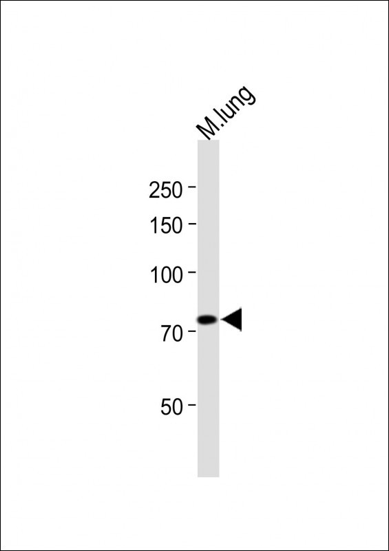 Rabbit Polyclonal Antibody to IDUA