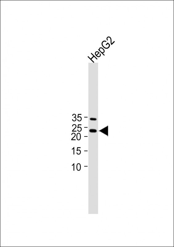 Rabbit Polyclonal Antibody to TC10
