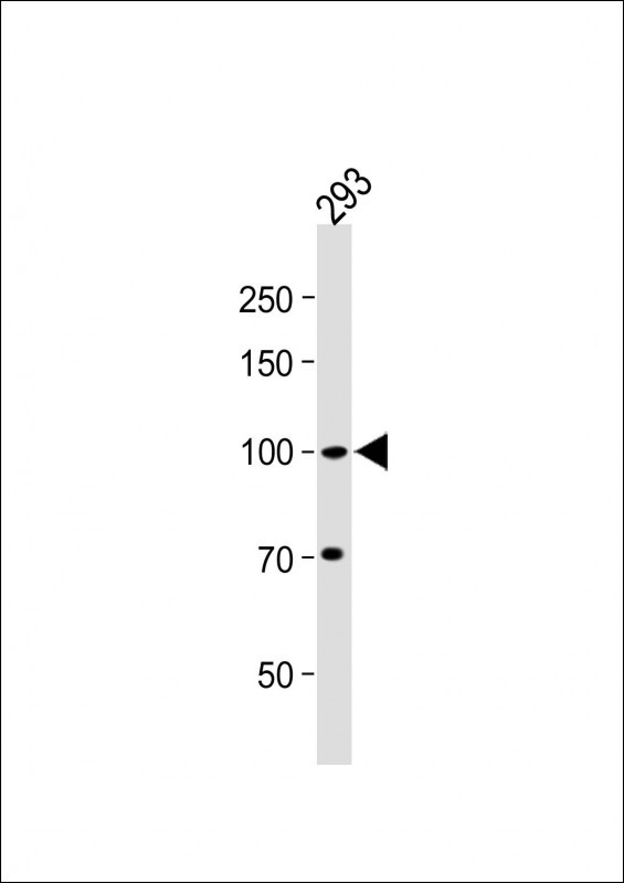 Rabbit Polyclonal Antibody to PKN beta