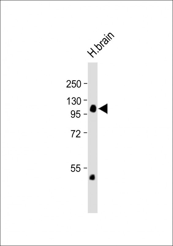 Rabbit Polyclonal Antibody to NCOA7 (N-term)