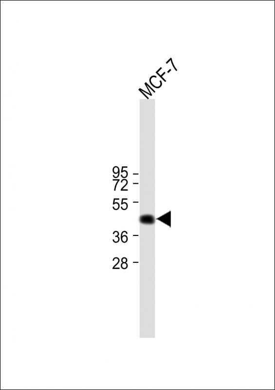 Rabbit Polyclonal Antibody to HAPLN1 (N-term)