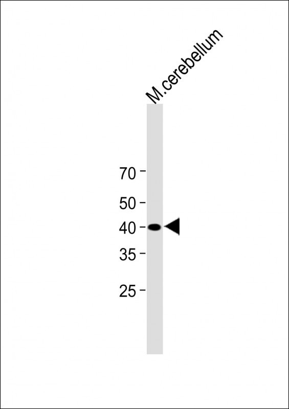 Rabbit Polyclonal Antibody to LRTM2