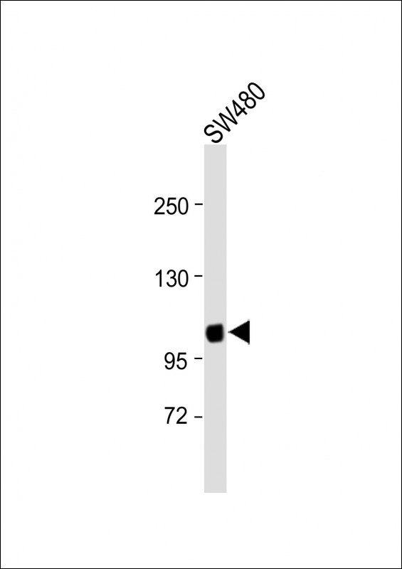 Rabbit Polyclonal Antibody to SUV4-20H1