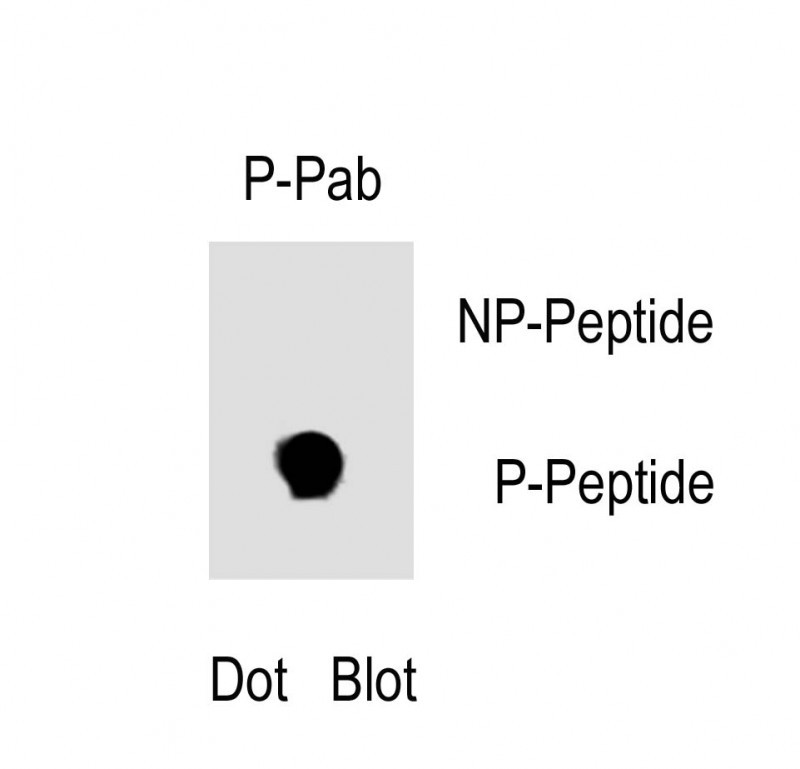 Rabbit Polyclonal Antibody to Phospho-EGFR(Y1125)