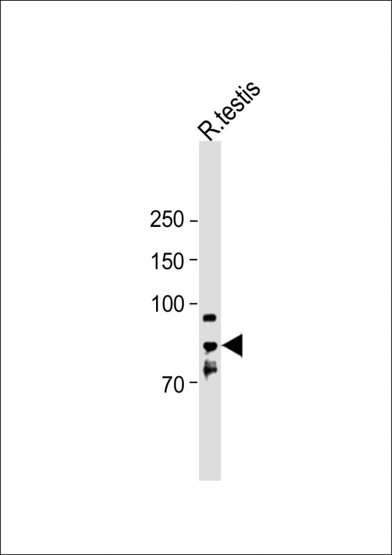 Rabbit Polyclonal Antibody to STRA6