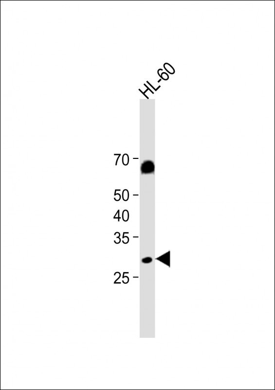 Rabbit Polyclonal Antibody to CLEC12A