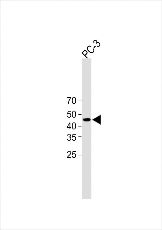 Rabbit Polyclonal Antibody to SPB4