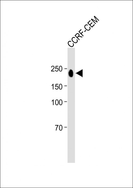 Rabbit Polyclonal Antibody to PTPRC (N-term)