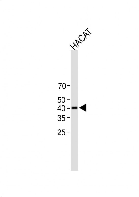 Rabbit Polyclonal Antibody to PAQR7