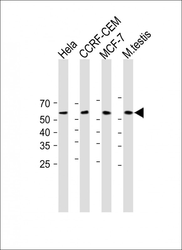 Rabbit Polyclonal Antibody to RBPJ (N-term)