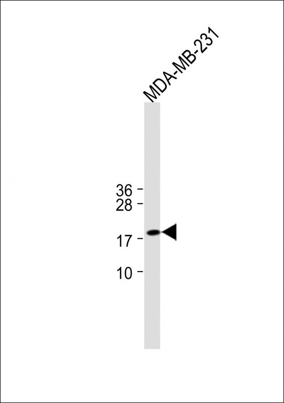Rabbit Polyclonal Antibody to ANKRD37(C-term)
