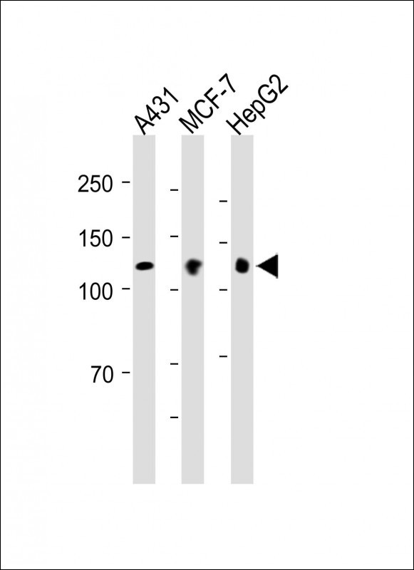 Rabbit Polyclonal Antibody to BMPR2 (N-term)