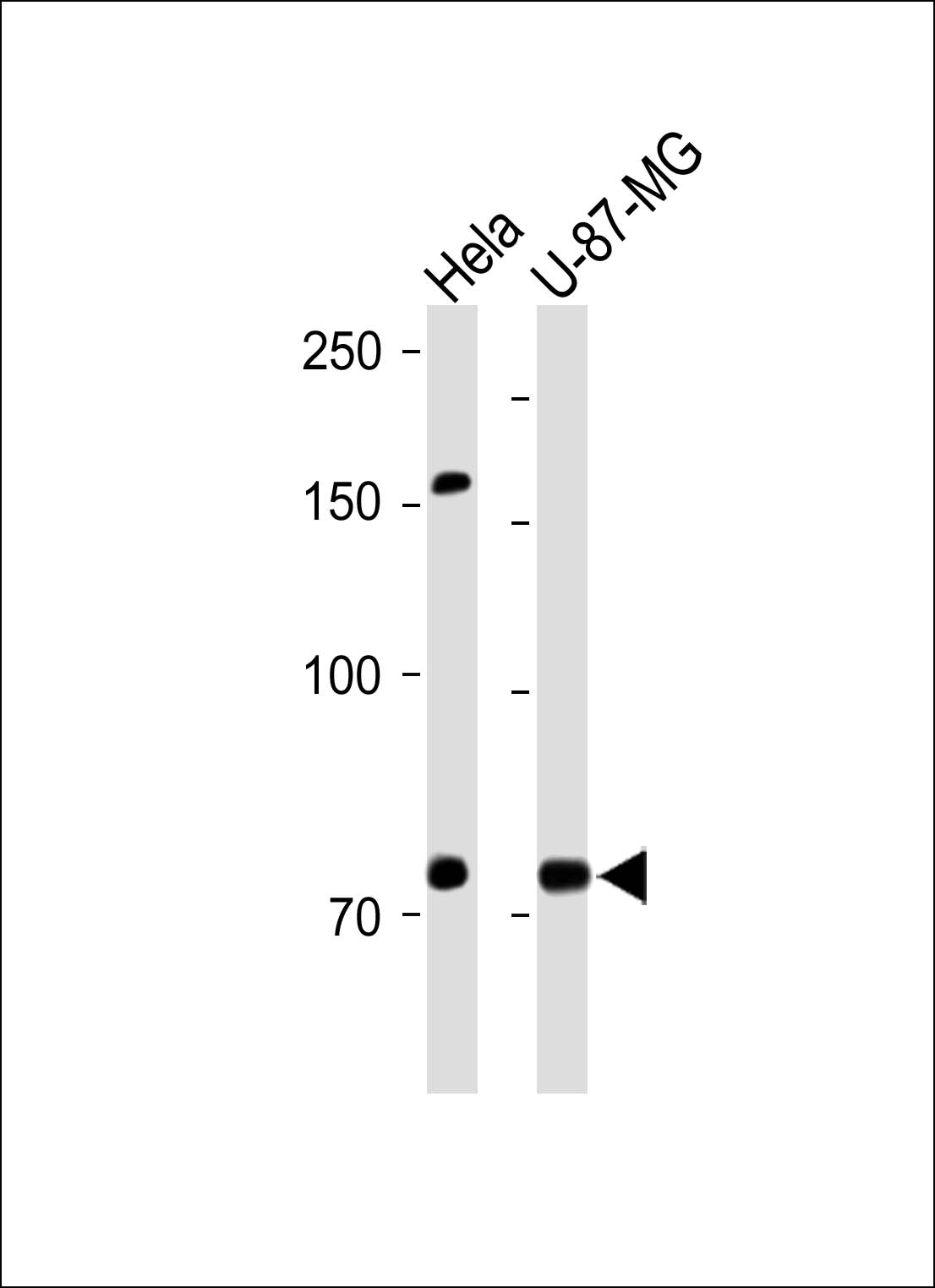 Rabbit Polyclonal Antibody to ITK (N-term)