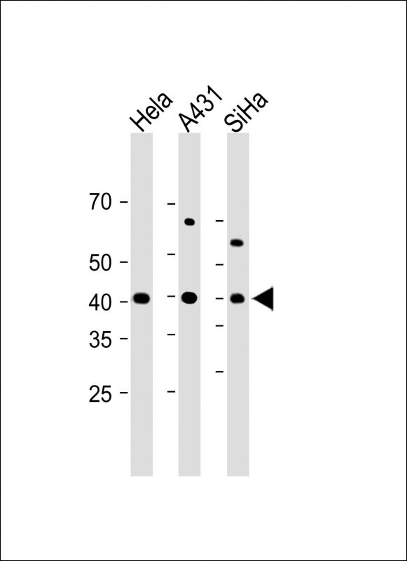 Rabbit Polyclonal Antibody to G6PC